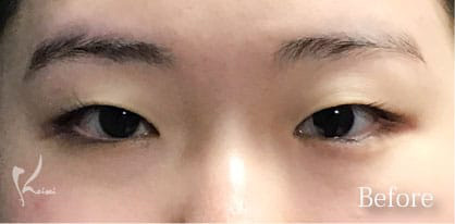 Before写真