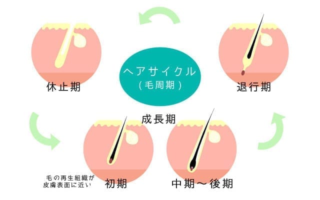 AGAによって短くなる毛髪のヘアサイクル