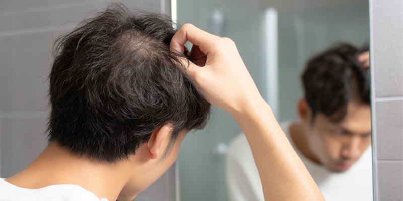 AGAと皮膚疾患による脱毛の違いを確認するイメージ