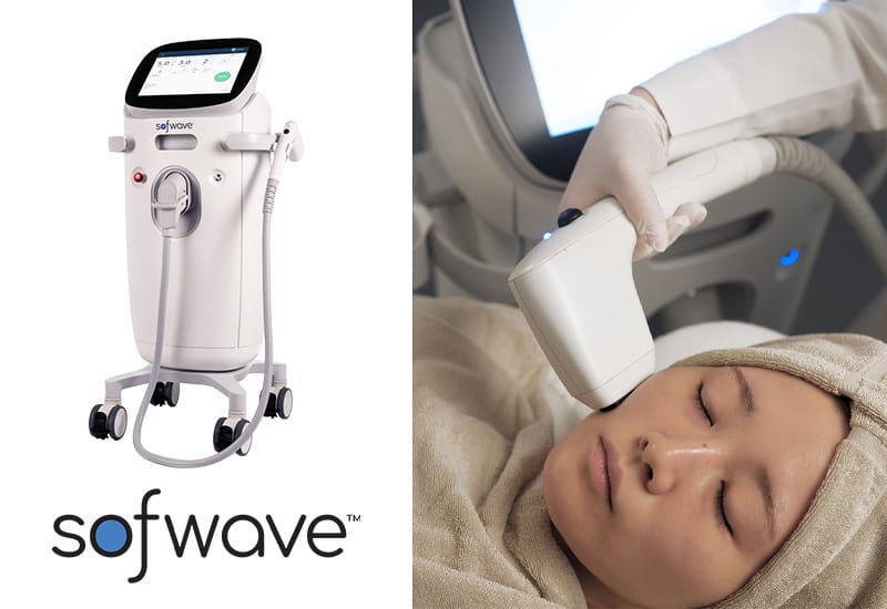 ソフウェーブの機器のイメージ