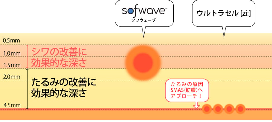 ソフウェーブと医療ハイフが作用する深さの違い