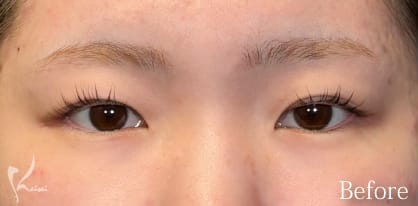 Before写真