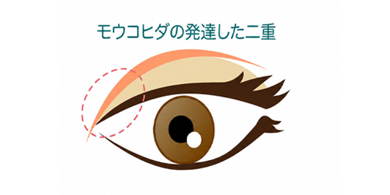 蒙古ひだの形を確認するイメージ