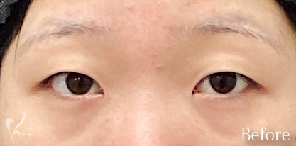 Before写真