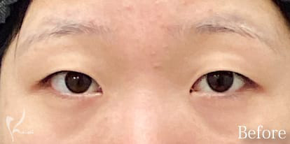 Before写真
