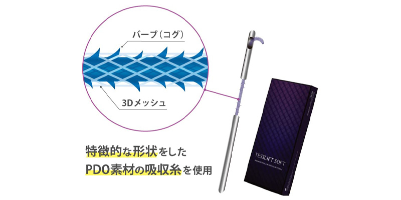 テスリフトのコグと3Dメッシュの構造