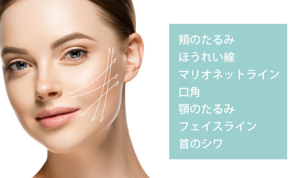 テスリフトソフトの施術部位のイメージ