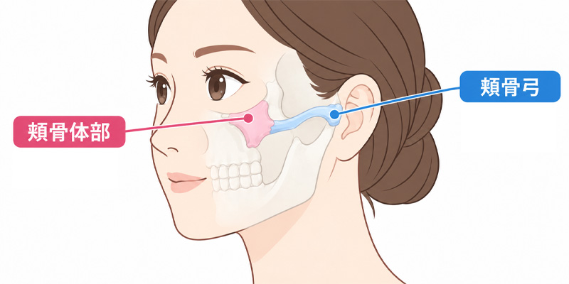 頬骨体部と頬骨弓の位置を確認するイメージ