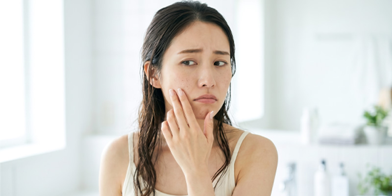 角質ケアのやりすぎによる乾燥や赤みのイメージ