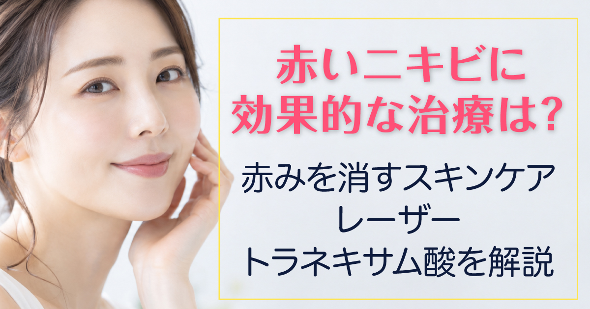 赤いニキビ跡の原因と治療方法を解説