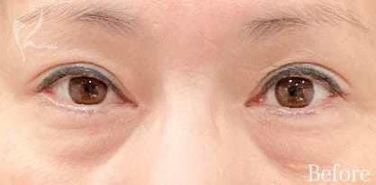 Before写真