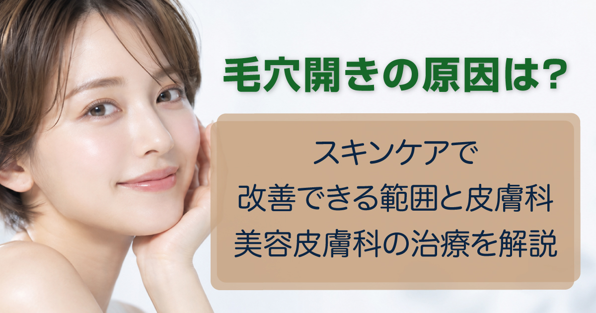 毛穴の開きの原因とスキンケア・美容医療による治療を解説