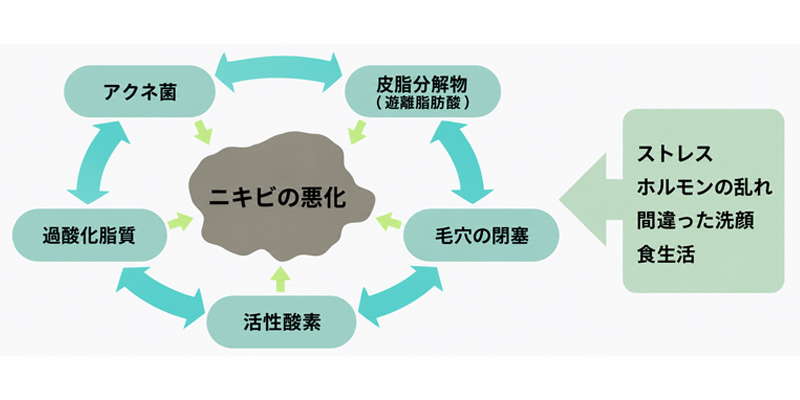 ニキビができる原因