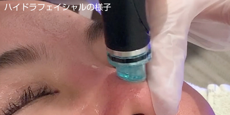 ハイドラフェイシャルの様子