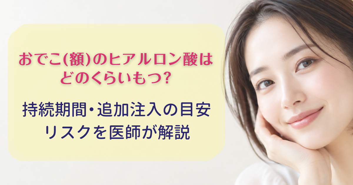 おでこのヒアルロン酸の持続期間と追加注入の目安を解説
