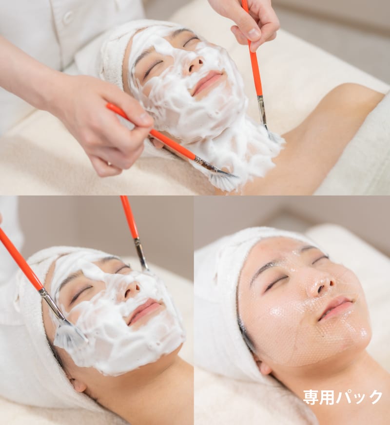 ララピール施術