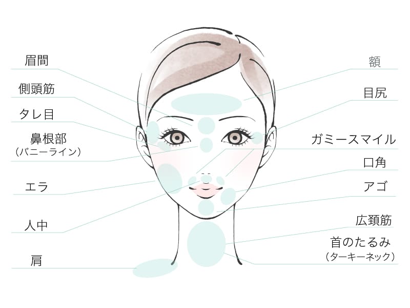 大阪でボトックス注射を検討する女性のイメージ