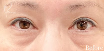 Before写真