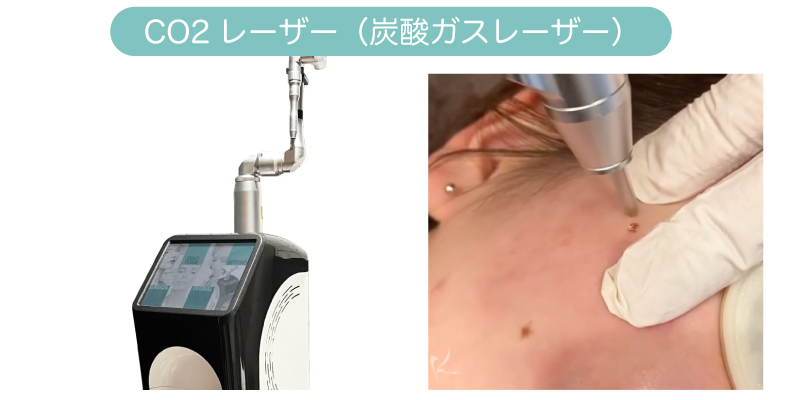 CO2レーザー
