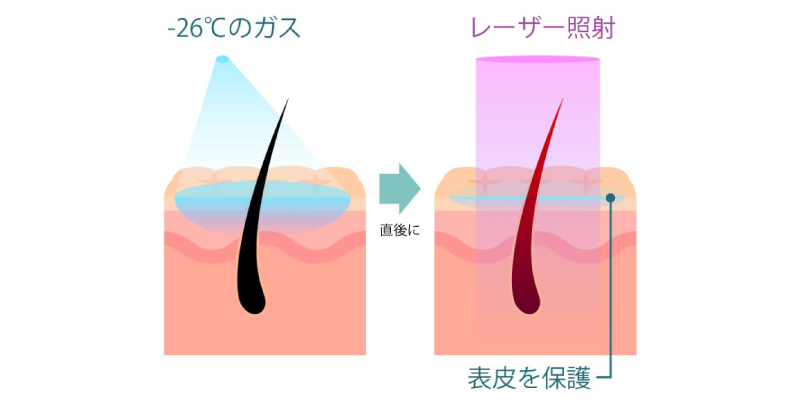 皮膚冷却システム