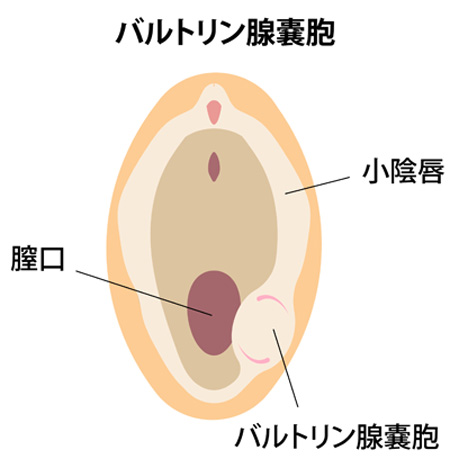 バルトリン腺嚢胞の位置と周囲の構造