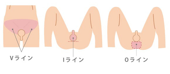 Vライン・Iライン・Oラインを表すイメージ