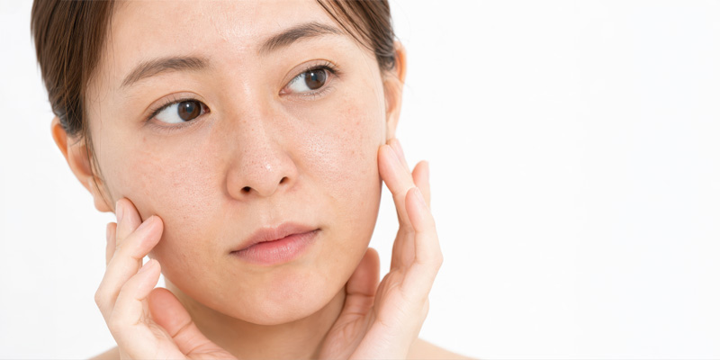 レチノールの使用によって起こる肌の赤みや乾燥、皮むけのイメージ