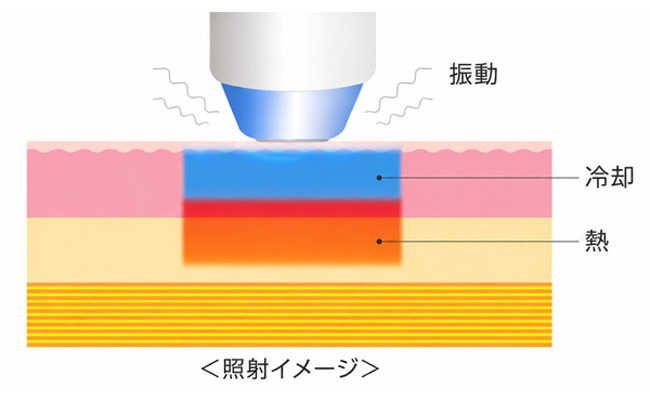 サーマクールFLXの冷却機能と振動機能のイメージ