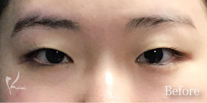 Before写真