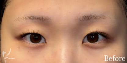 Before写真