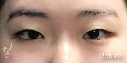 Before写真