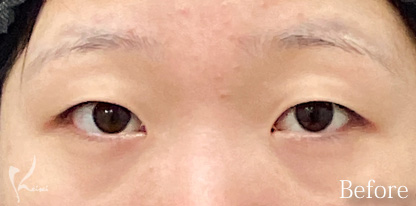 Before写真