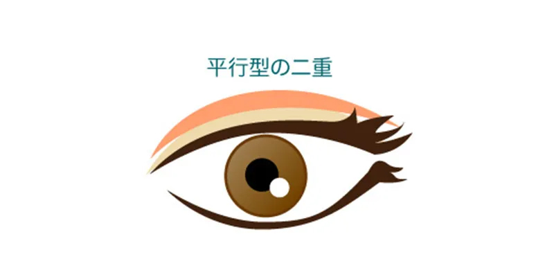 平行二重の形を説明するイメージ