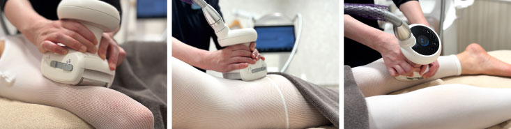 医療用エンダモロジー ダイエット 痩身 メディカルダイエット endermologie M6 INFINITY(エンダモロジーM6 インフィニティ)施術中写真