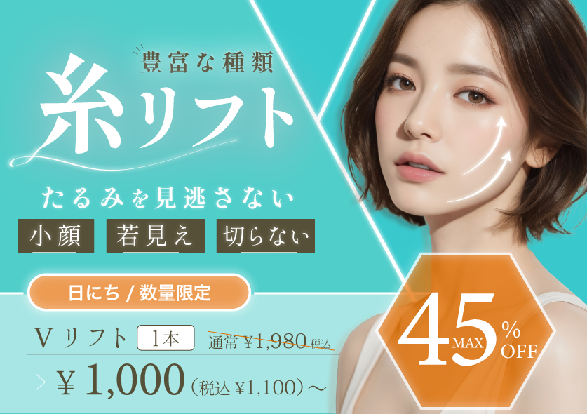 糸リフト