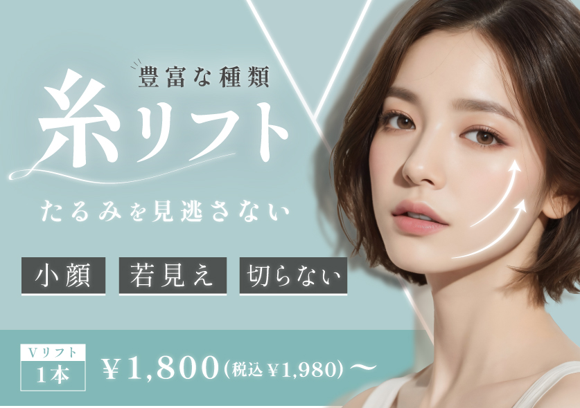 糸リフト
