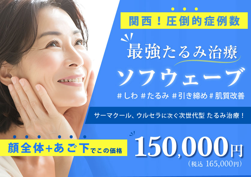 ソフウェーブ