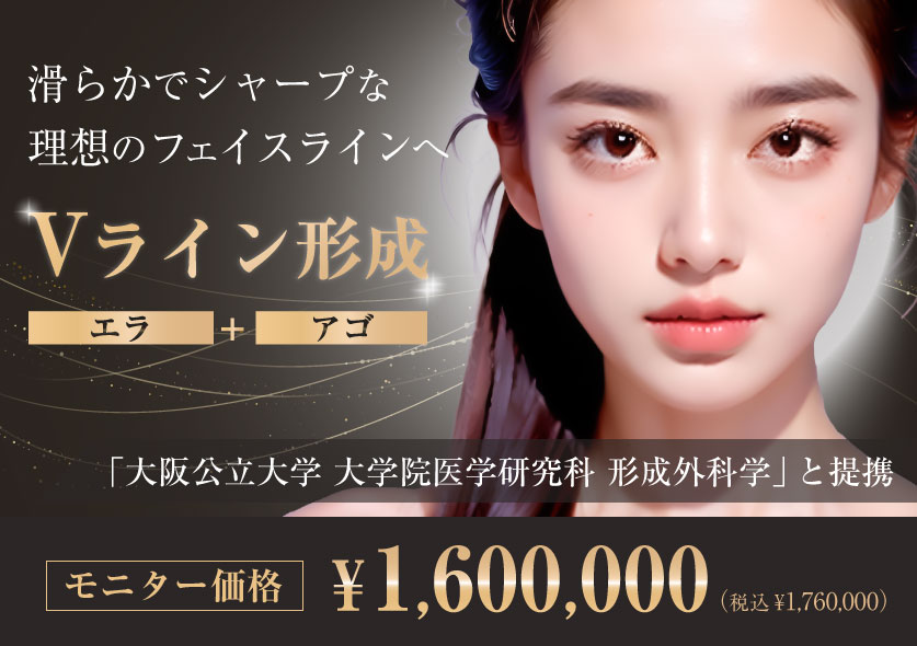 Vライン形成モニター価格