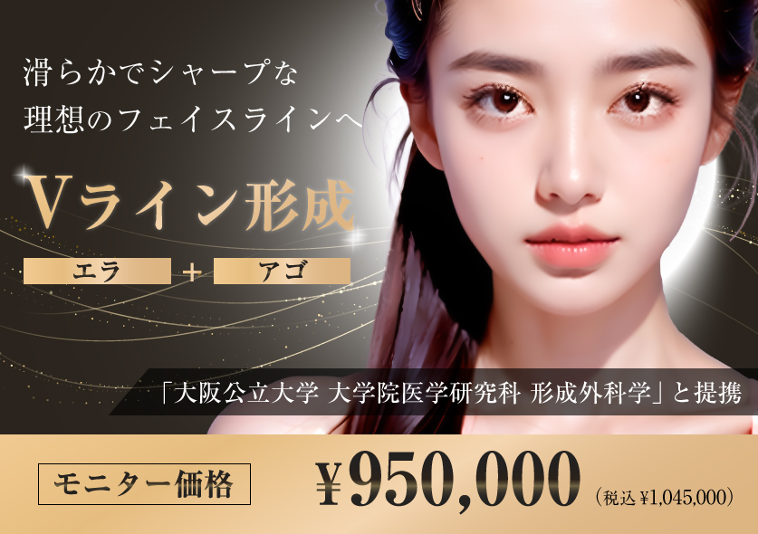 Vライン形成