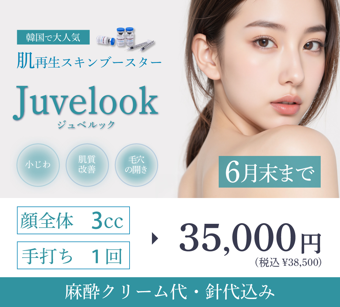 ジュベルックキャンペーンバナー