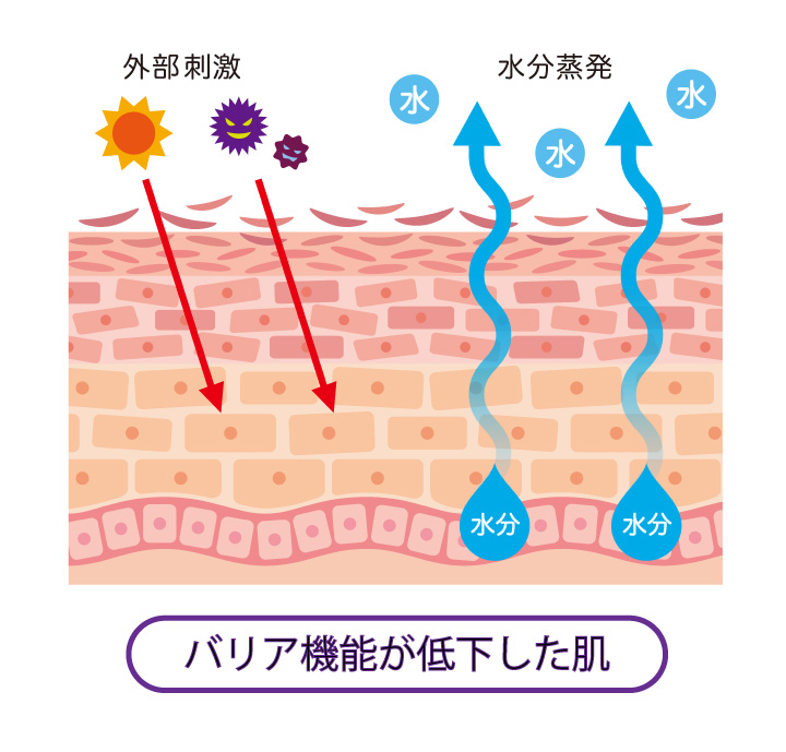 バリア機能が低下した肌の外部から受ける刺激の様子