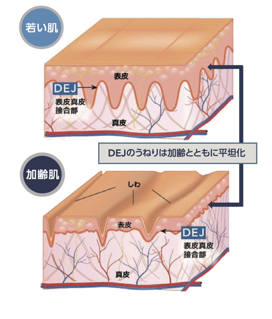 DEJのうねりの画像