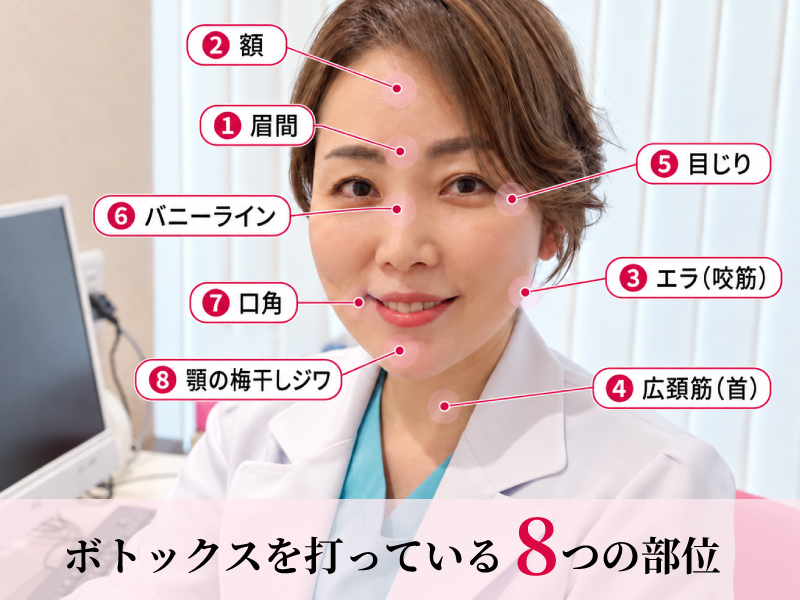 小西医師　ボトックスしている箇所