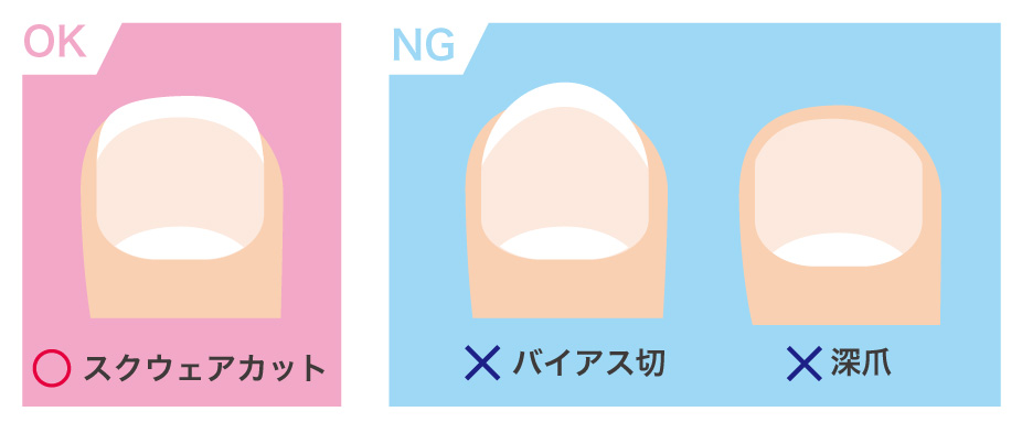 正しい爪の切り方