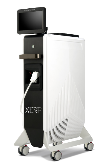 XERF（ザーフ）