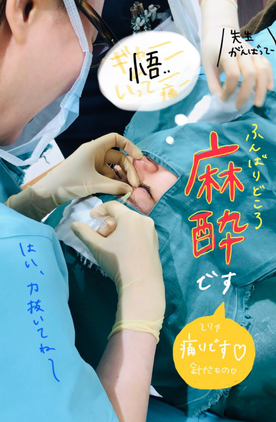 二重 埋没法 手術 麻酔