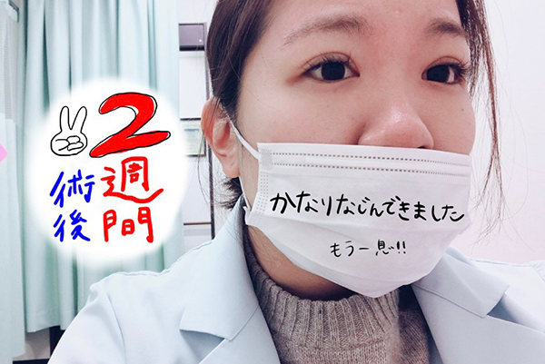 恵聖会クリニック 松本医師 二重埋没法 2週間後