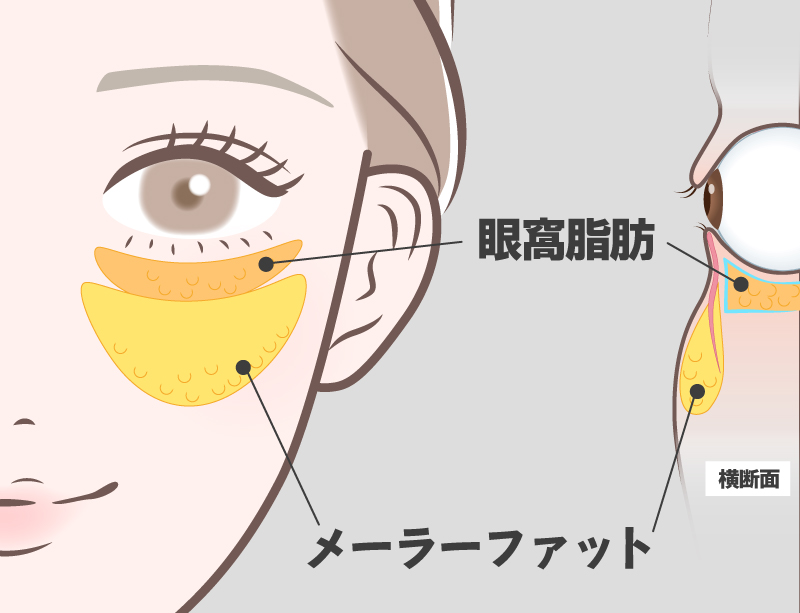 メーラーファット解説図