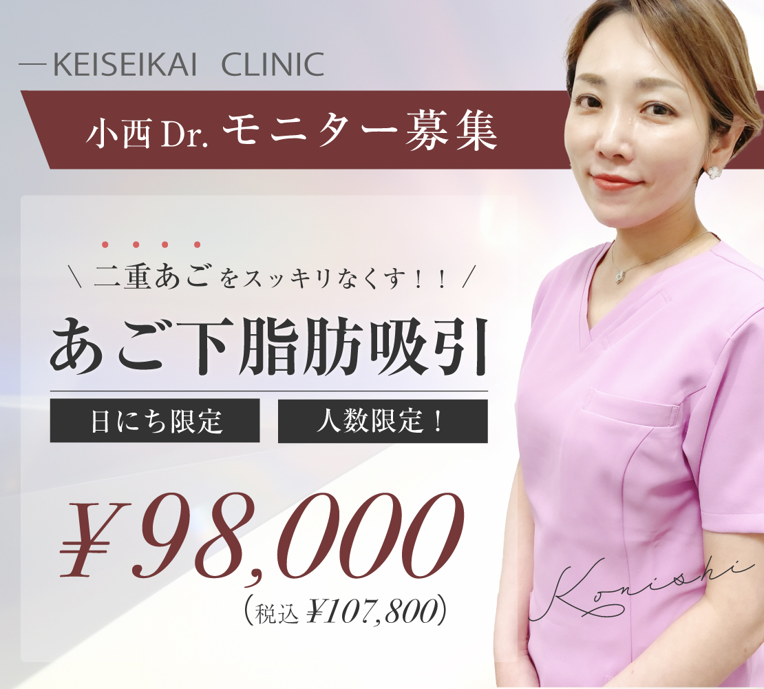 「あご下脂肪吸引」モニター募集