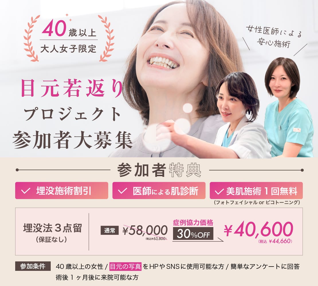 目元若返りプロジェクト参加者大募集
